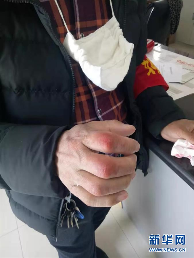 （在習(xí)近平新時(shí)代中國特色社會主義思想指引下——新時(shí)代新作為新篇章·習(xí)近平總書記關(guān)切事·圖文互動）（2）戰(zhàn)“疫”中的“凡人微光”