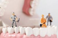 【健康解碼】洗牙會損害牙齒嗎？